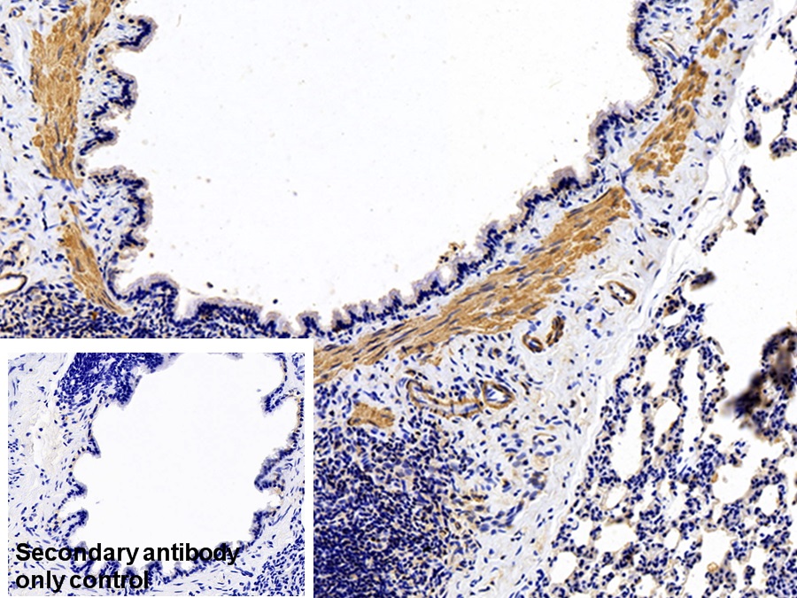 Monoclonal Antibody to Actin Alpha 1, Cardiac Muscle (ACTC1)