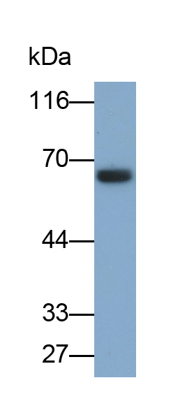 Monoclonal Antibody to Glucokinase Regulatory Protein (GKRP)