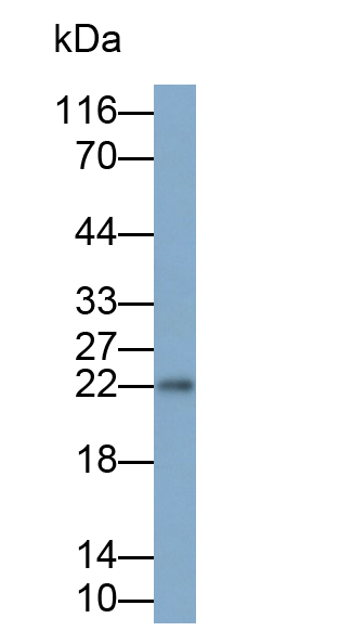 Monoclonal Antibody to Neutrophil gelatinase-associated lipocalin (NGAL)