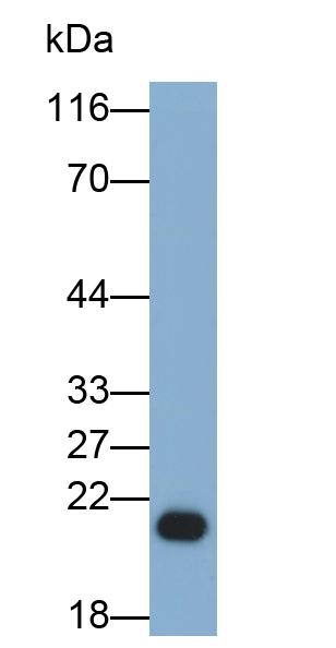 Monoclonal Antibody to Neutrophil gelatinase-associated lipocalin (NGAL)