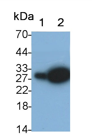 Monoclonal Antibody to Neutrophil gelatinase-associated lipocalin (NGAL)