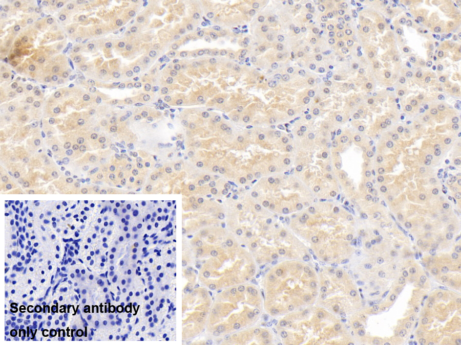 Monoclonal Antibody to Lipopolysaccharide Binding Protein (LBP)