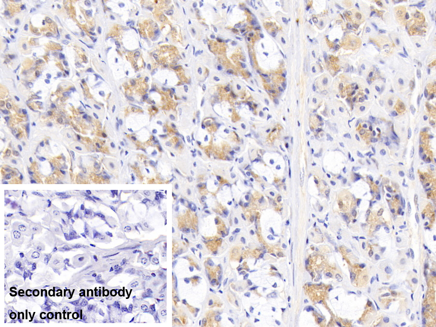 Monoclonal Antibody to Lipopolysaccharide Binding Protein (LBP)