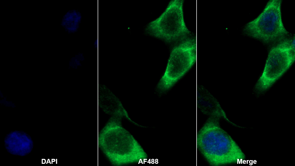 Monoclonal Antibody to Cluster Of Differentiation 97 (CD97)