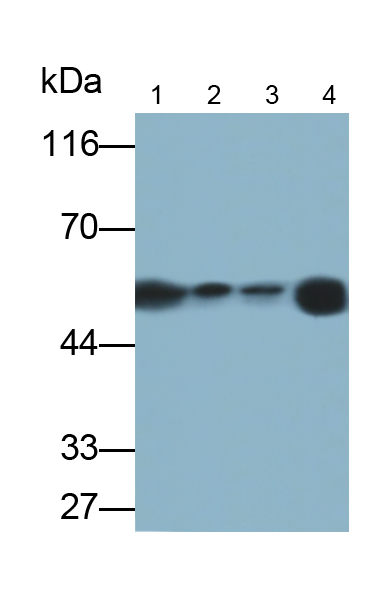 Monoclonal Antibody to Interferon Alpha/Beta Receptor 1 (IFNa/bR1)