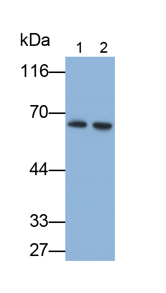 Monoclonal Antibody to Interferon Alpha/Beta Receptor 1 (IFNa/bR1)