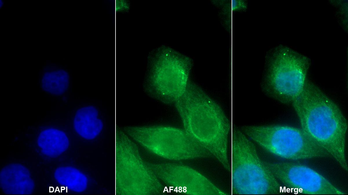 Monoclonal Antibody to Acetylcholinesterase (ACHE)