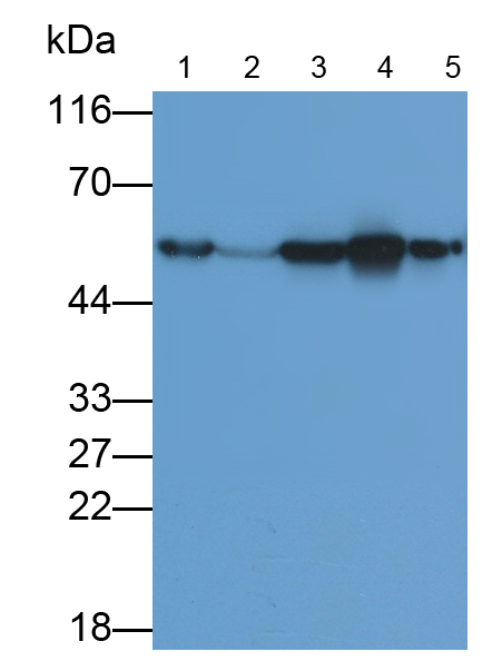 Monoclonal Antibody to Calreticulin (CALR)