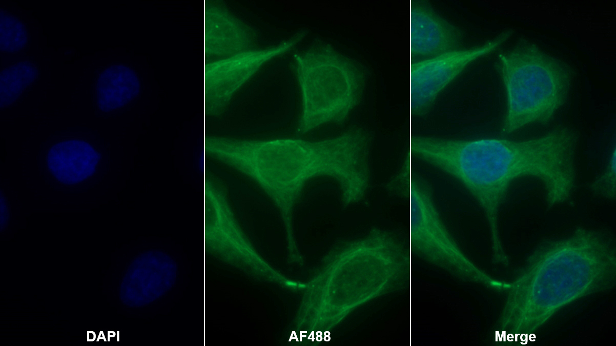 Monoclonal Antibody to Calreticulin (CALR)