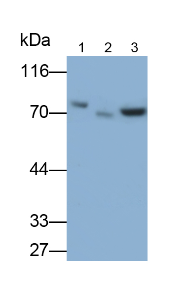 Monoclonal Antibody to Interleukin 1 Receptor Associated Kinase 3 (IRAK3)