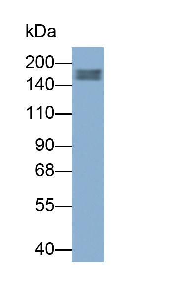 Monoclonal Antibody to Mannose Receptor C Type 1 (MRC1)