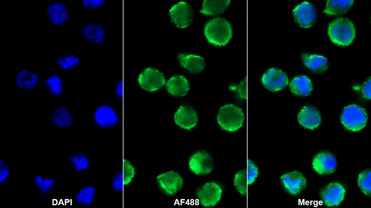 Monoclonal Antibody to Bone Marrow Stromal Cell Antigen 1 (BST1)