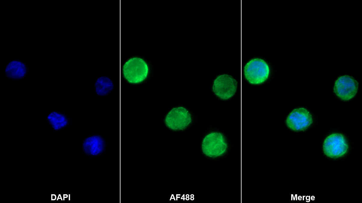 Monoclonal Antibody to Bone Marrow Stromal Cell Antigen 1 (BST1)