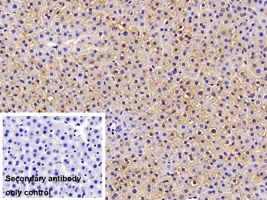 Monoclonal Antibody to Fatty Acid Binding Protein 1 (FABP1)