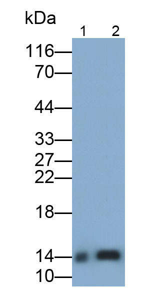 Monoclonal Antibody to Fatty Acid Binding Protein 1 (FABP1)