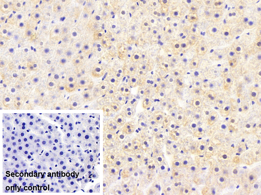 Monoclonal Antibody to Fatty Acid Binding Protein 1 (FABP1)