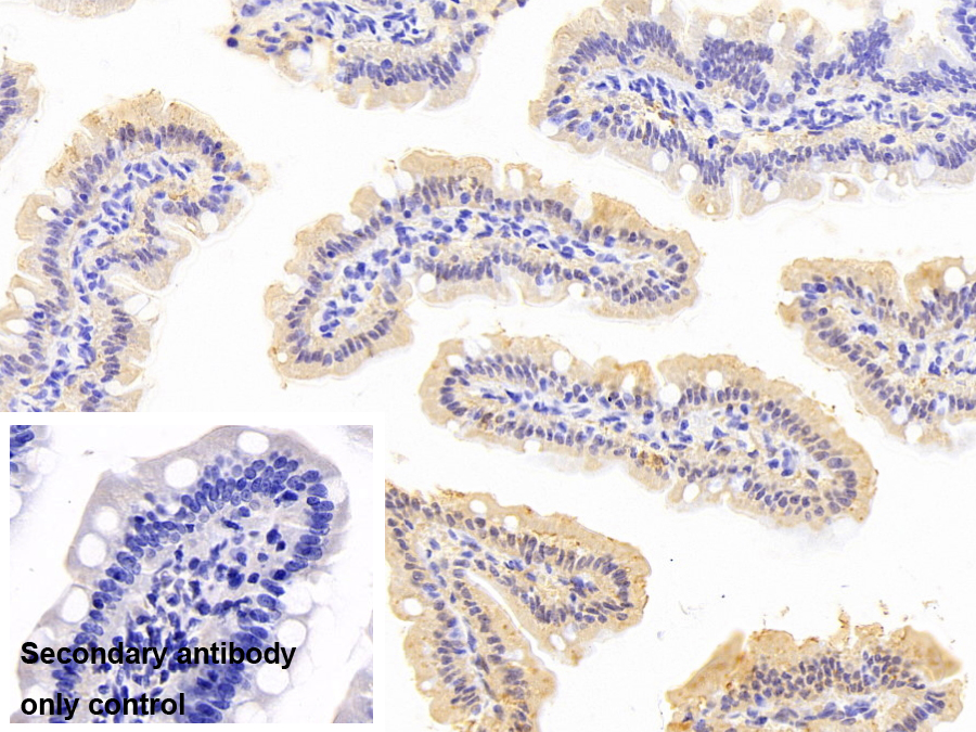 Monoclonal Antibody to Fatty Acid Binding Protein 1 (FABP1)