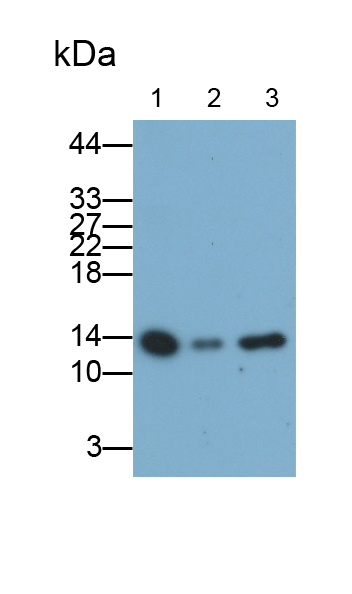 Monoclonal Antibody to Fatty Acid Binding Protein 1 (FABP1)
