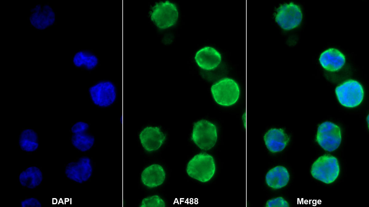 Monoclonal Antibody to Tyrosine Kinase 2 (Tyk2)