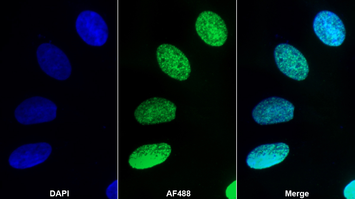 Monoclonal Antibody to Tyrosine Kinase 2 (Tyk2)