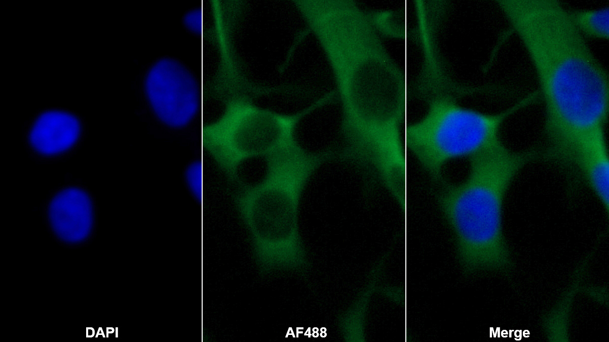 Monoclonal Antibody to Major Basic Protein (MBP)