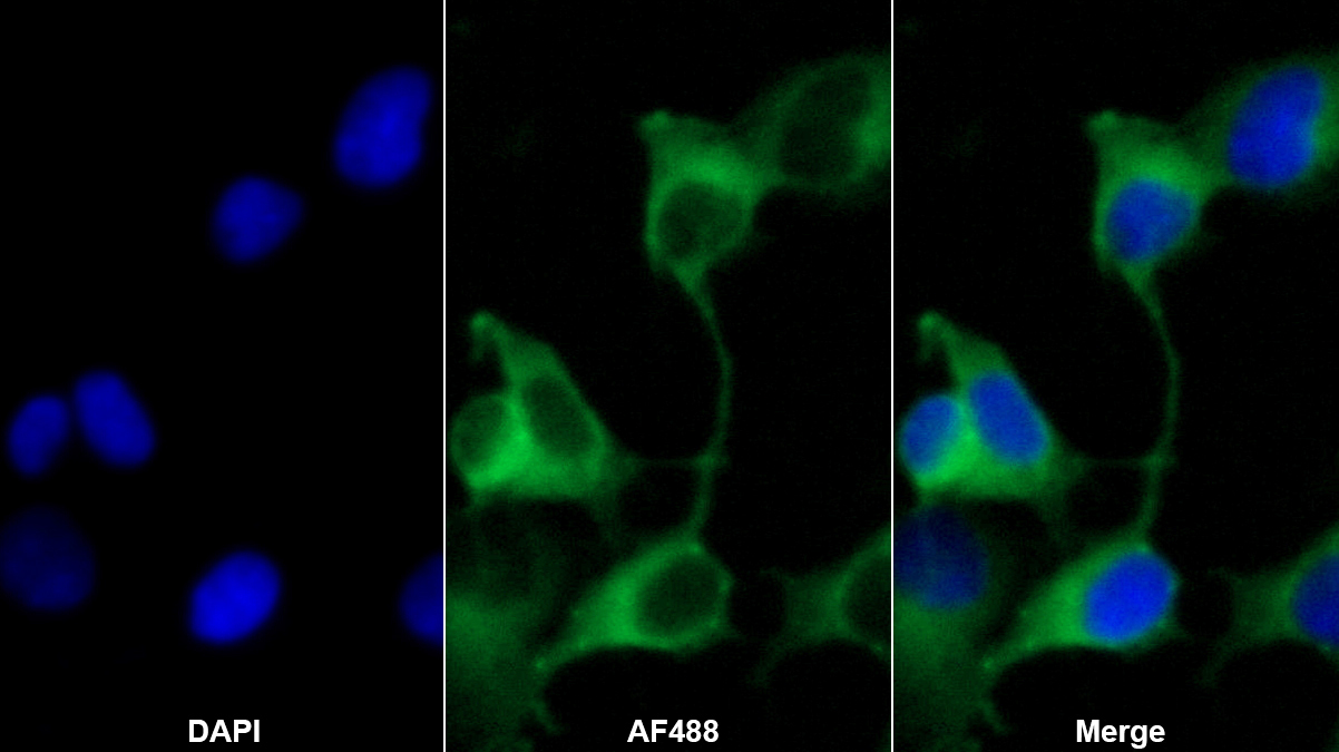 Monoclonal Antibody to Major Basic Protein (MBP)