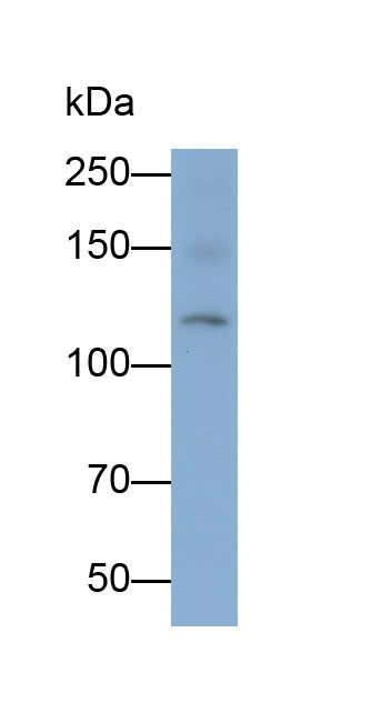 Monoclonal Antibody to Permeability Glycoprotein (Pgp)