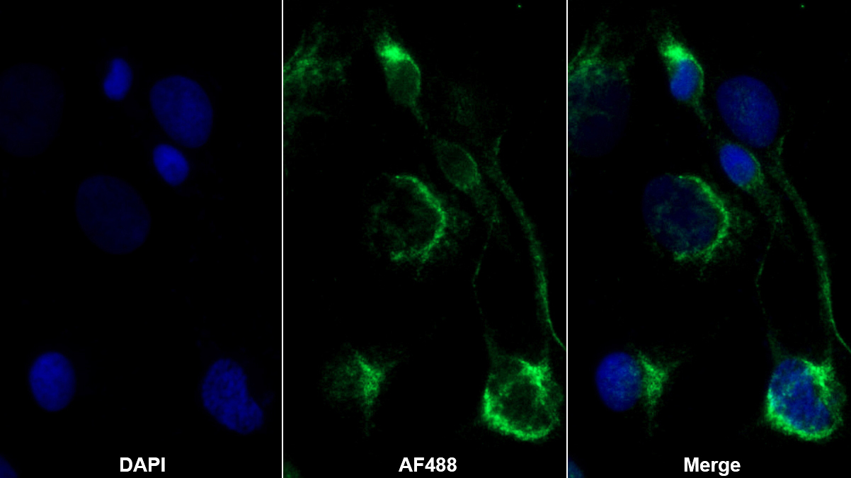 Monoclonal Antibody to Permeability Glycoprotein (Pgp)