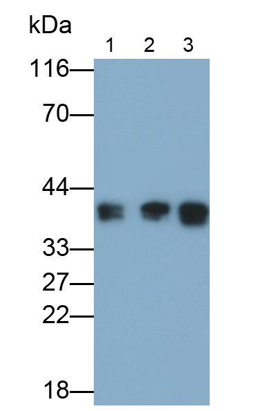 Monoclonal Antibody to Lactate Dehydrogenase B (LDHB)