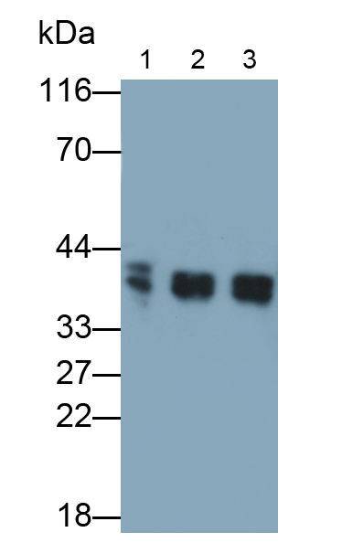 Monoclonal Antibody to Lactate Dehydrogenase B (LDHB)