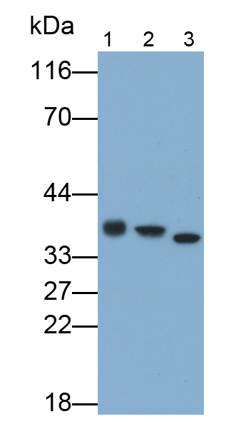 Monoclonal Antibody to Lactate Dehydrogenase B (LDHB)