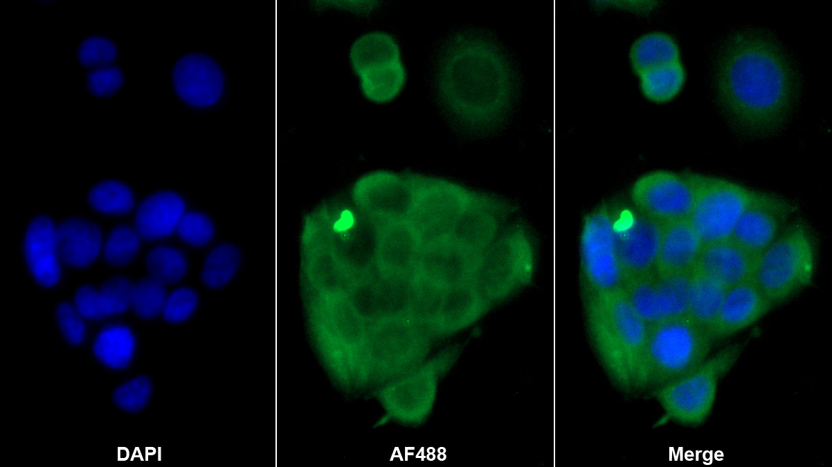 Monoclonal Antibody to S100 Calcium Binding Protein A6 (S100A6)