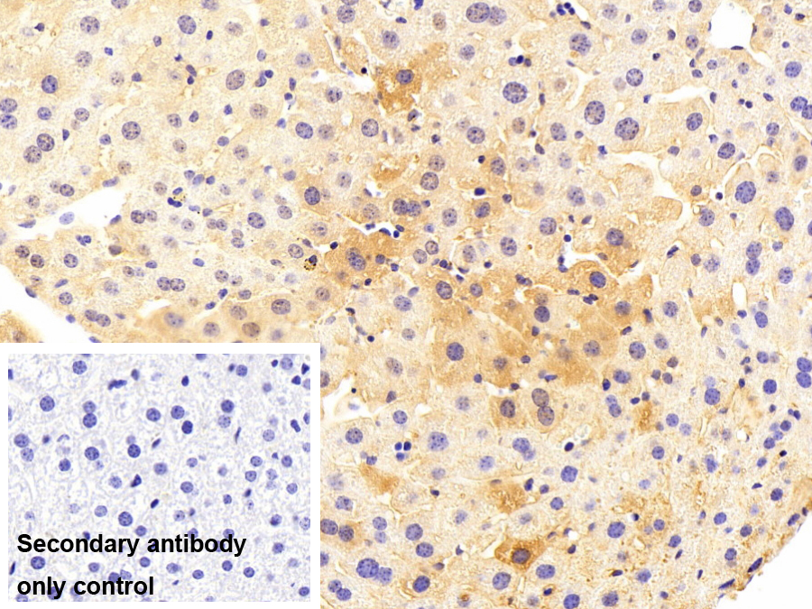Monoclonal Antibody to Orosomucoid 2 (ORM2)