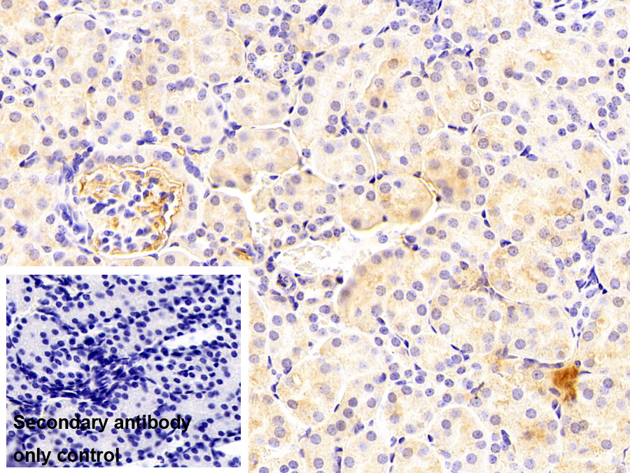Monoclonal Antibody to Orosomucoid 2 (ORM2)