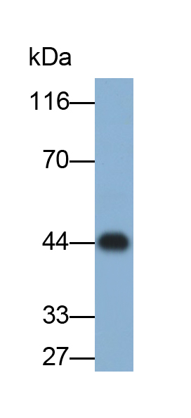 Monoclonal Antibody to Orosomucoid 2 (ORM2)