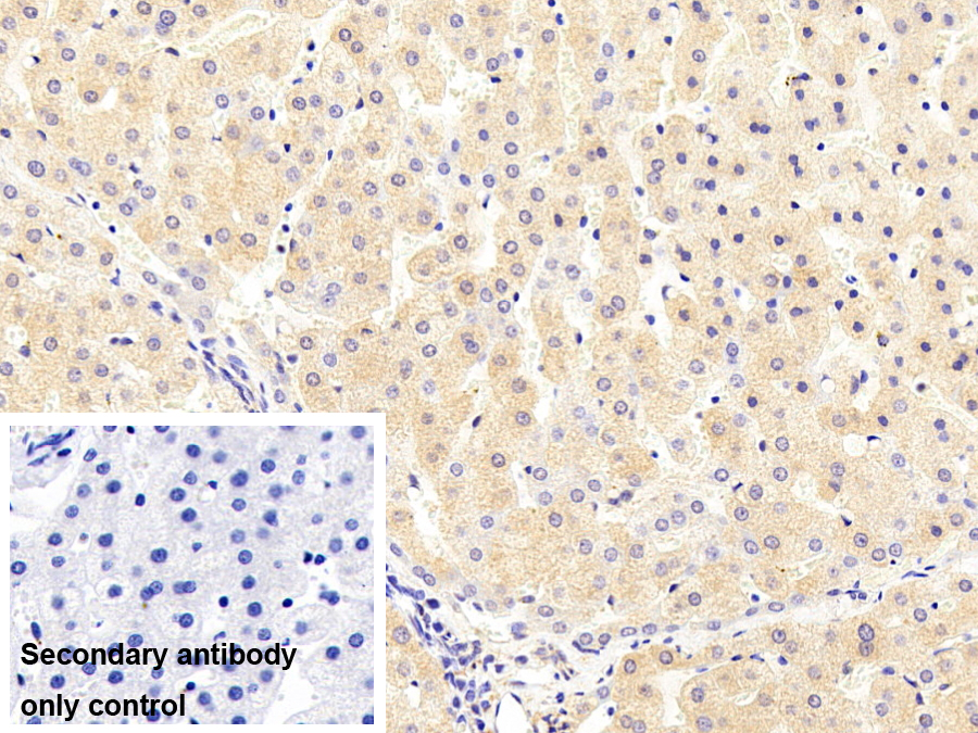 Monoclonal Antibody to Orosomucoid 2 (ORM2)