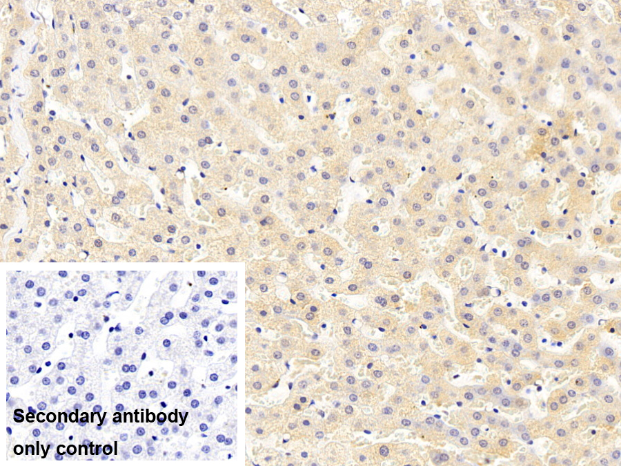 Monoclonal Antibody to Orosomucoid 2 (ORM2)