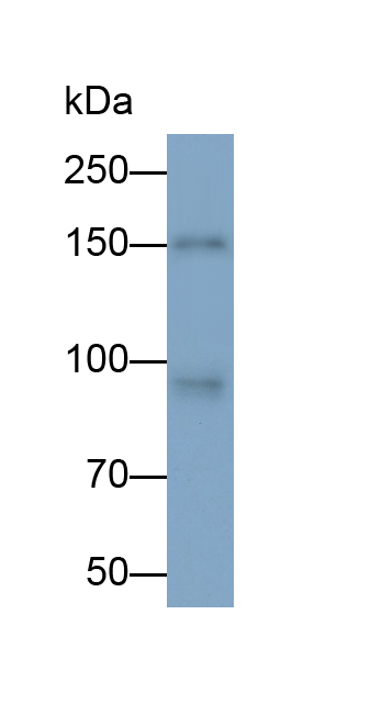 Monoclonal Antibody to Fibroblast Growth Factor Receptor 1 (FGFR1)