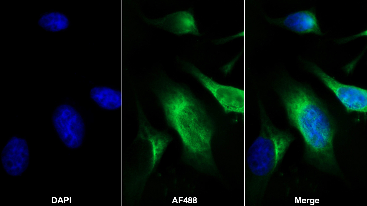 Monoclonal Antibody to Cluster Of Differentiation 5 (CD5)