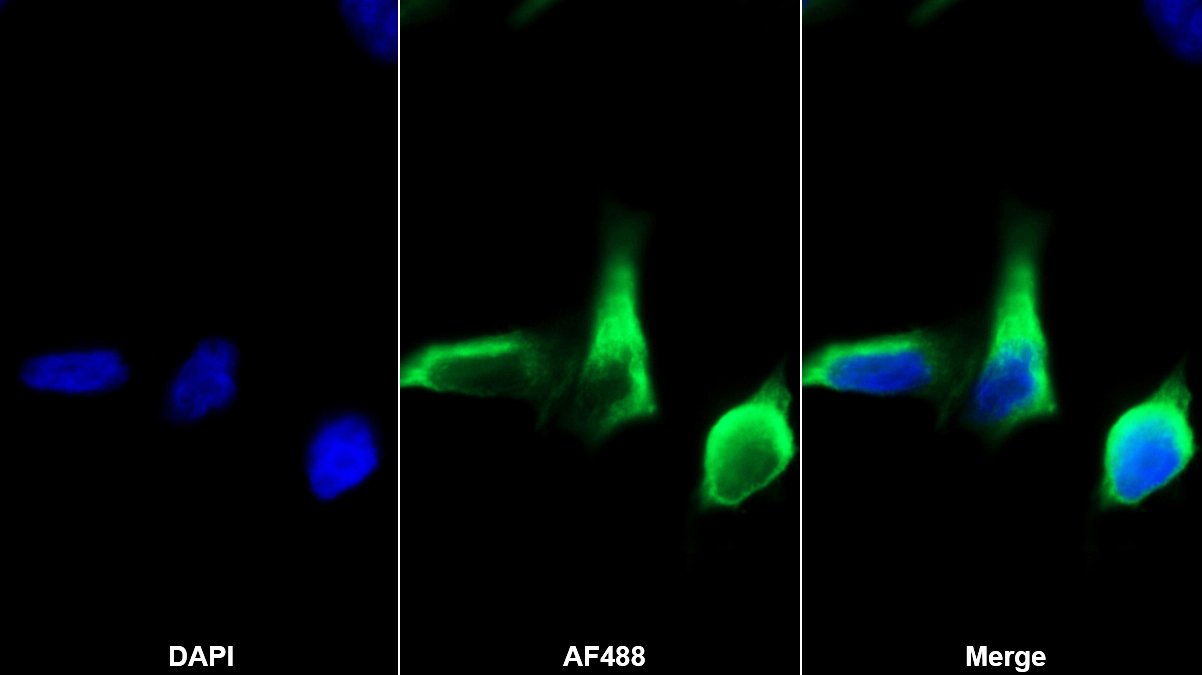 Monoclonal Antibody to Cluster Of Differentiation 5 (CD5)