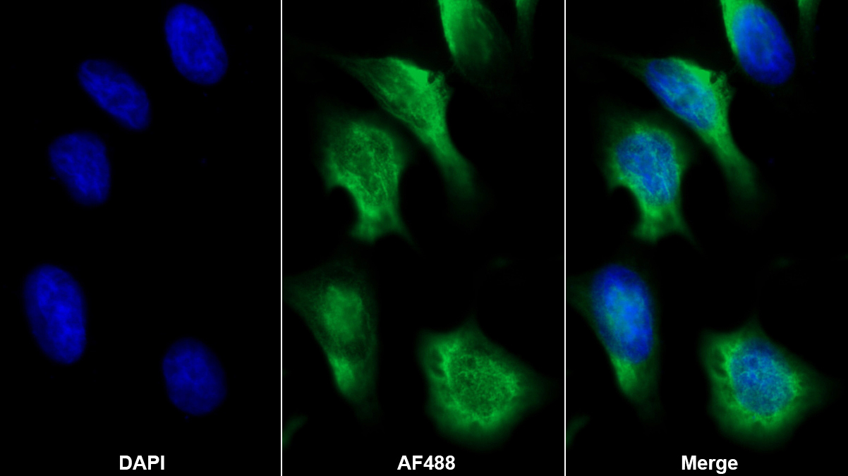 Monoclonal Antibody to Cluster Of Differentiation 5 (CD5)