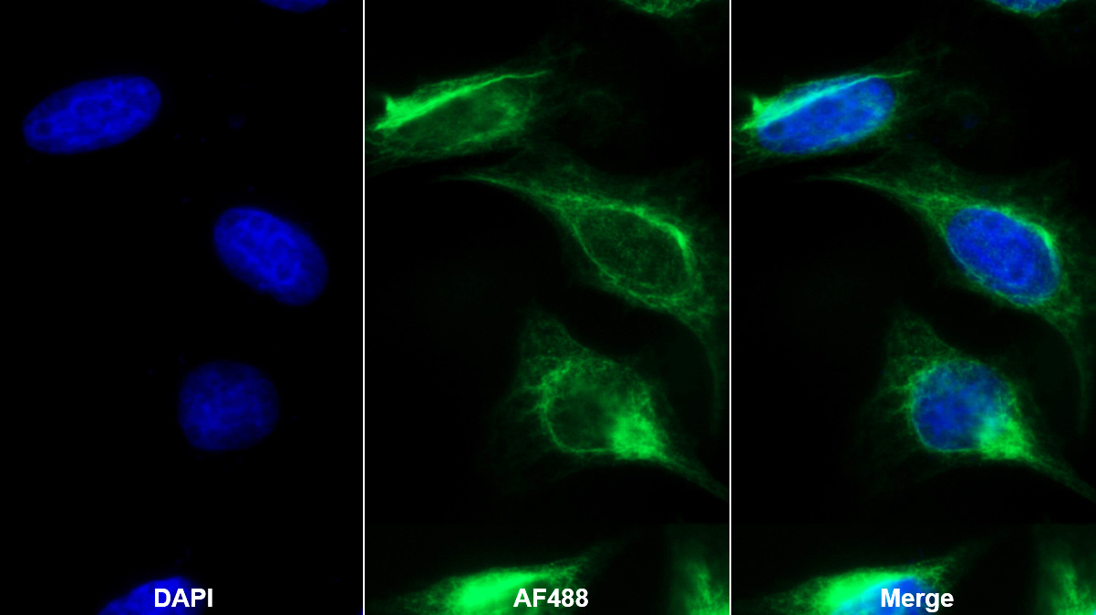 Monoclonal Antibody to Cluster Of Differentiation 5 (CD5)