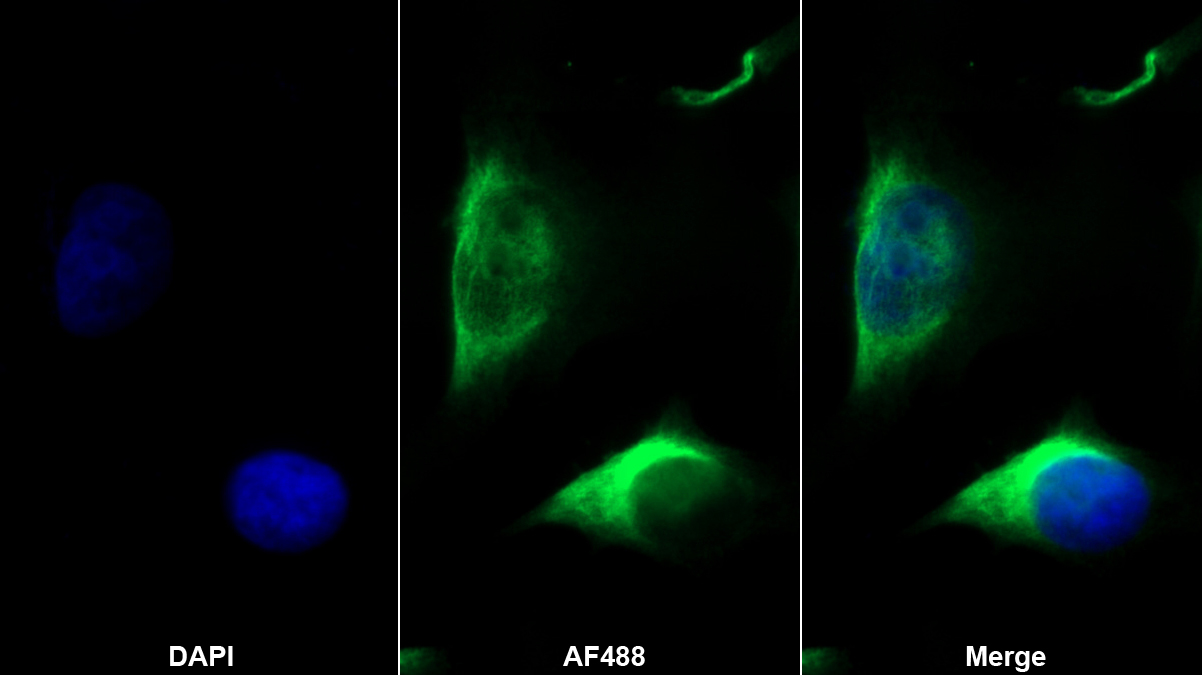 Monoclonal Antibody to Cluster Of Differentiation 5 (CD5)