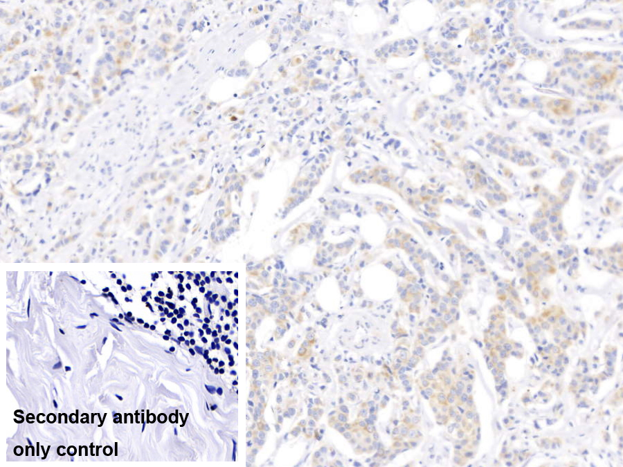 Monoclonal Antibody to Cytokeratin 17 (CK17)