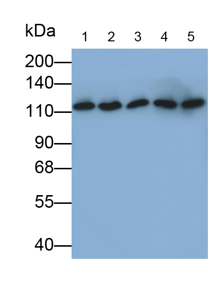 Monoclonal Antibody to Vinculin (VCL)