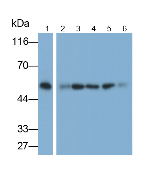 Monoclonal Antibody to Tubulin Beta (TUBb)