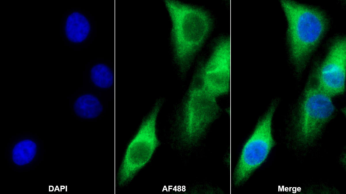 Monoclonal Antibody to Fibroblast Growth Factor 10 (FGF10)