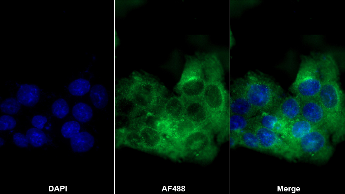 Monoclonal Antibody to Apolipoprotein C3 (APOC3)