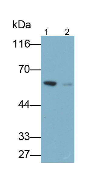 Monoclonal Antibody to Interleukin 7 Receptor (IL7R)