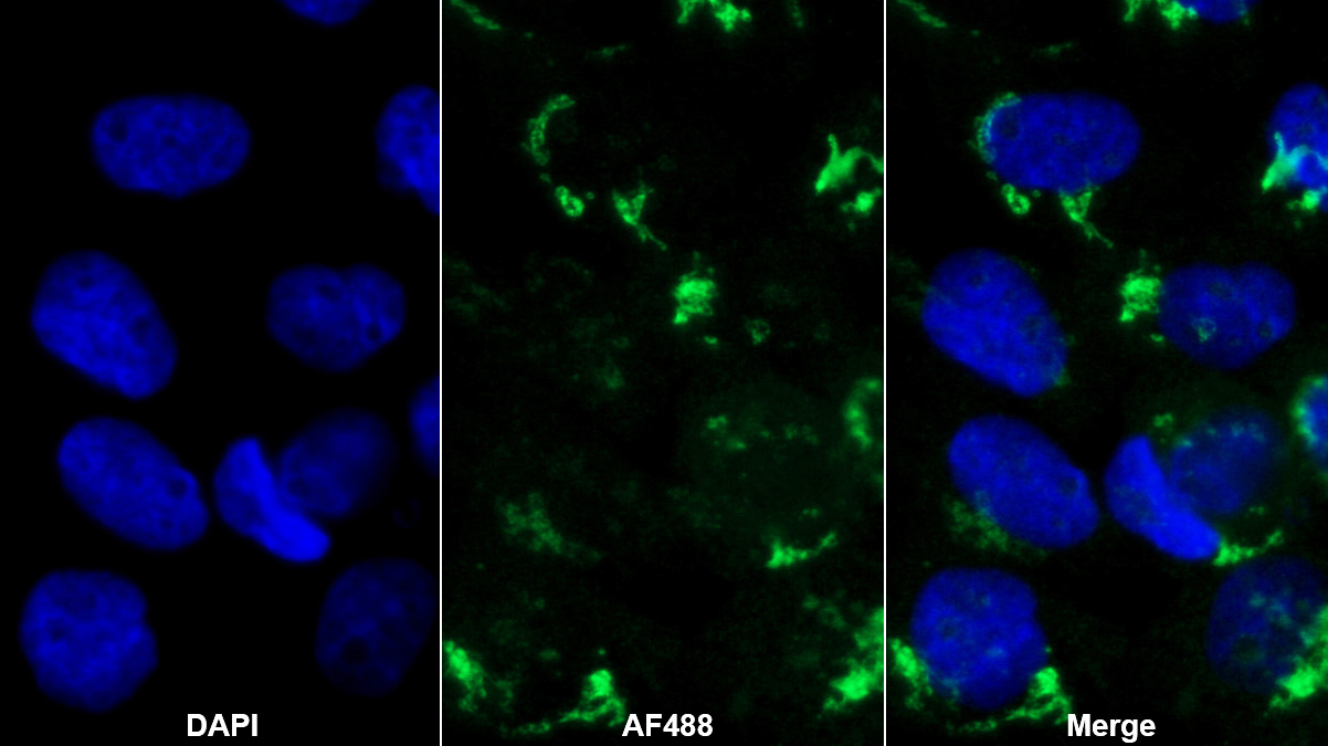 Monoclonal Antibody to Monokine Induced By Interferon Gamma (MIg)